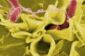 Salmonella used to kill cancer cells