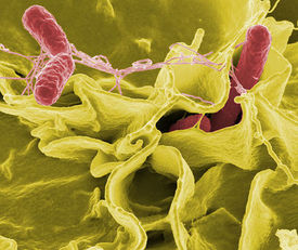 Salmonella used to kill cancer cells
