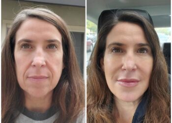 The Patient-First Philosophy of Eternia Medspa